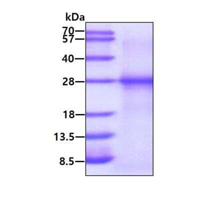 SDS-PAGE: Recombinant Human RPE His Protein [NBP1-99080]