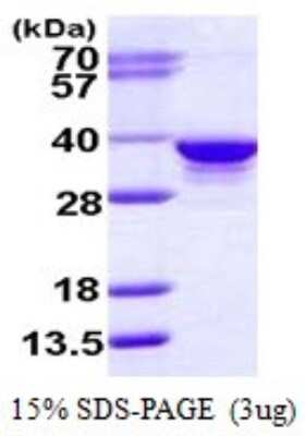 SDS-PAGE: Recombinant Human RPIA His Protein [NBP1-78855]