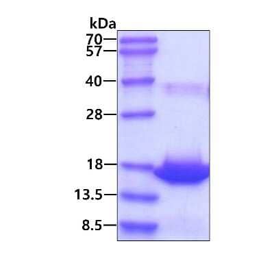 SDS-PAGE: Recombinant Human RPLP2 His Protein [NBP1-99112]