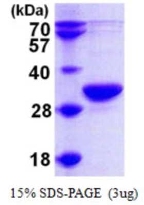 SDS-PAGE: Recombinant Human RPP30 His Protein [NBP1-50905]