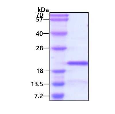 SDS-PAGE: Recombinant Human RPS13 His Protein [NBP2-23429]