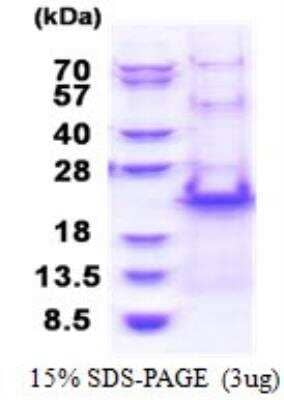 SDS-PAGE: Recombinant Human RPS20 His Protein [NBP2-23434]