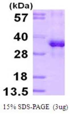 SDS-PAGE: Recombinant Human RPS3 His Protein [NBP1-72495]