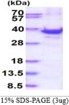 SDS-PAGE: Recombinant Human RPS3A His Protein [NBP1-98950]