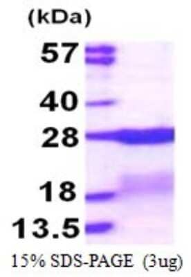 SDS-PAGE: Recombinant Human RPS7 His Protein [NBP1-72552]