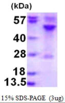 SDS-PAGE: Recombinant Human RRAGC His Protein [NBP1-99083]