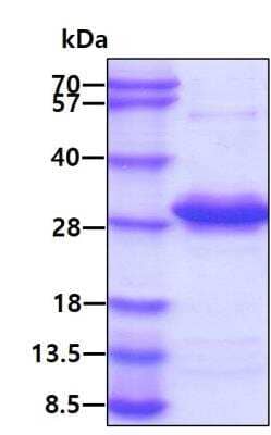 SDS-PAGE: Recombinant Human RRAS His Protein [NBP1-44492]