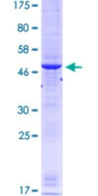 SDS-PAGE: Recombinant Human RRM1 GST (N-Term) Protein [H00006240-Q02]