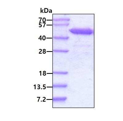 SDS-PAGE: Recombinant Human RRM2 His Protein [NBP1-44468]