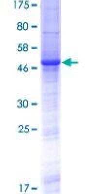 SDS-PAGE: Recombinant Human RS1 GST (N-Term) Protein [H00006247-P01]