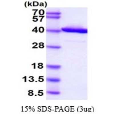 SDS-PAGE: Recombinant Human RTN4IP1 His Protein [NBP1-78859]