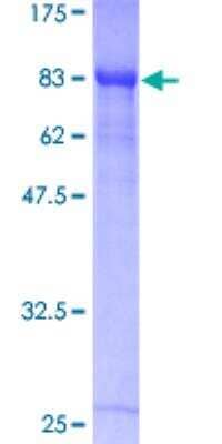 SDS-PAGE: Recombinant Human RUNX1T1/ETO GST (N-Term) Protein [H00000862-P01]