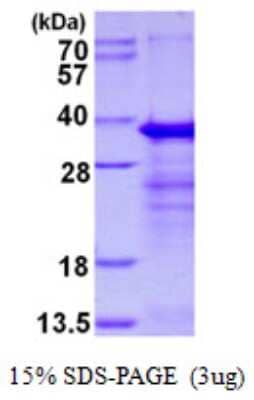 SDS-PAGE: Recombinant Human RYBP/DEDAF His Protein [NBP1-98929]