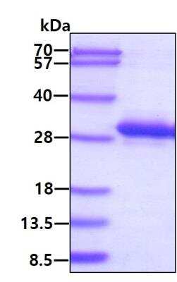 SDS-PAGE: Recombinant Human Rab11A His Protein [NBP1-44381]