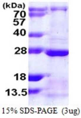 SDS-PAGE: Recombinant Human Rab13 His Protein [NBP1-72372]