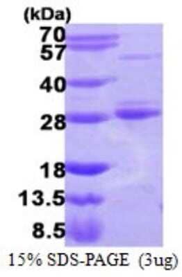 SDS-PAGE: Recombinant Human Rab17 His Protein [NBP1-72354]