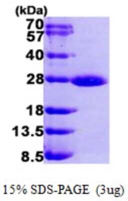 SDS-PAGE: Recombinant Human Rab1A His Protein [NBP1-50980]