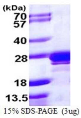 SDS-PAGE: Recombinant Human Rab2 His Protein [NBP1-72344]