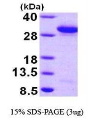 SDS-PAGE: Recombinant Human Rab27a His Protein [NBP1-44380]