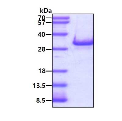 SDS-PAGE: Recombinant Human Rab3D His Protein [NBP1-72348]