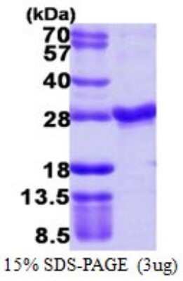 SDS-PAGE: Recombinant Human Rab4 His Protein [NBP1-72350]