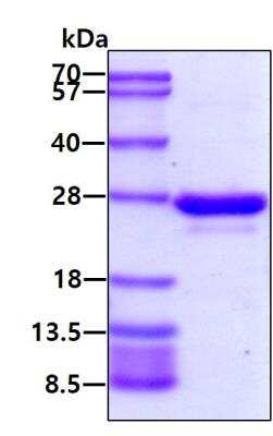 SDS-PAGE: Recombinant Human Rab5a Protein [NBC1-18504]