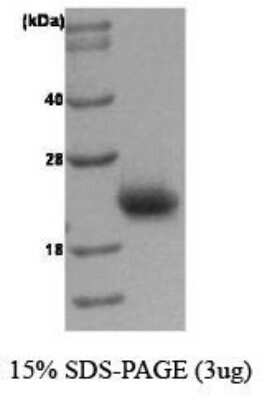 SDS-PAGE: Recombinant Human Rac1 Protein [NBC1-18385]