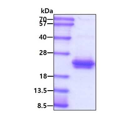 SDS-PAGE: Recombinant Human Rac1 Protein [NBC1-18385]