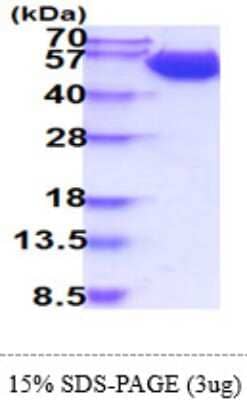 SDS-PAGE: Recombinant Human CD98 His Protein [NBP2-61178]