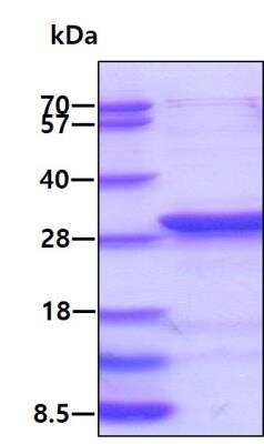 SDS-PAGE: Recombinant Human RalA/RalB His Protein [NBP1-50906]