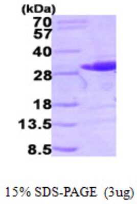 SDS-PAGE: Recombinant Human RalB His Protein [NBP1-50923]