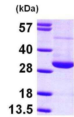 SDS-PAGE: Recombinant Human Ran His Protein [NBP1-45255]