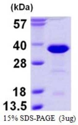 SDS-PAGE: Recombinant Human RanBP1 His Protein [NBP1-99058]