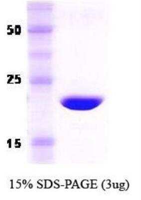 SDS-PAGE: Recombinant Human Recoverin Protein [NBC1-18499]