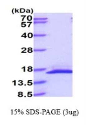 SDS-PAGE: Recombinant Human Reg4 His Protein [NBP2-77506]