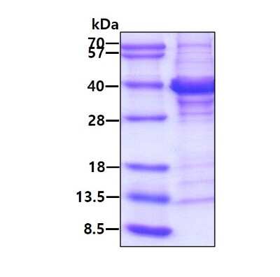 SDS-PAGE: Recombinant Human Regucalcin His Protein [NBP1-72431]