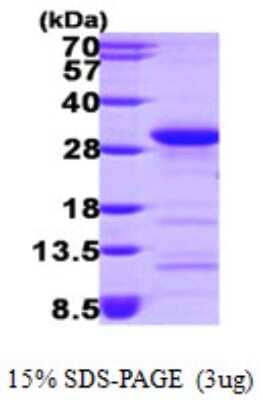 SDS-PAGE: Recombinant Human RhoA His Protein [NBP1-50933]