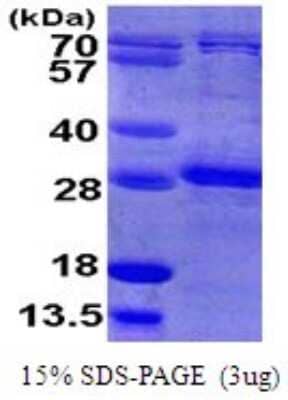 SDS-PAGE: Recombinant Human RhoB His Protein [NBP1-72304]