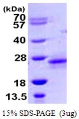 SDS-PAGE: Recombinant Human RhoD His Protein [NBP1-51072]