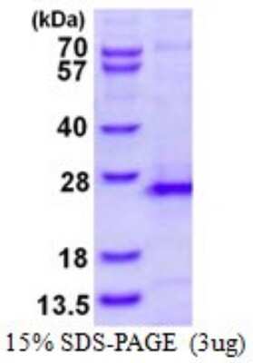 SDS-PAGE: Recombinant Human RhoG His Protein [NBP1-98934]