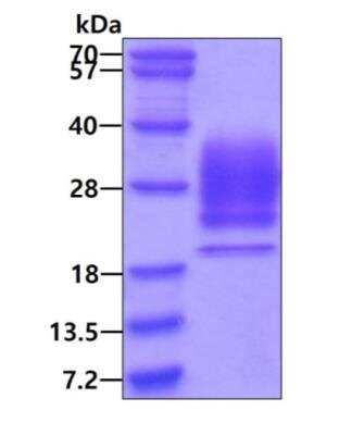 SDS-PAGE: Recombinant Human Ribonuclease A His Protein [NBP3-12164]