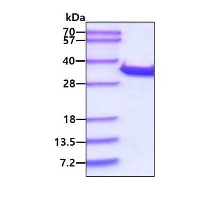 SDS-PAGE: Recombinant Human Ribosome maturation protein SBDS His Protein [NBP1-49450]