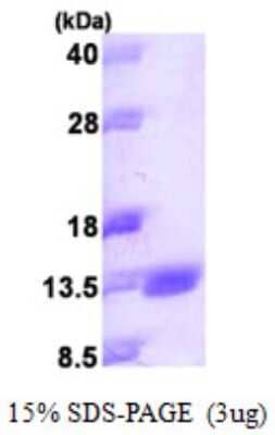 SDS-PAGE: Recombinant Human S100 calcium binding protein A14 His Protein [NBP1-51039]