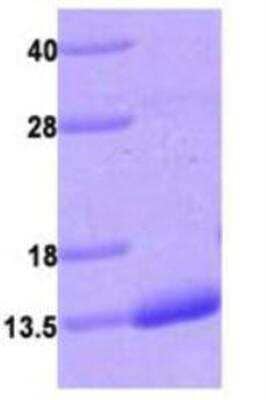 SDS-PAGE: Recombinant Human S100A4 His Protein [NBC1-27983]
