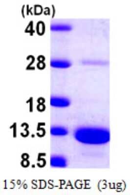 SDS-PAGE: Recombinant Human S100A5 His Protein [NBP1-51030]