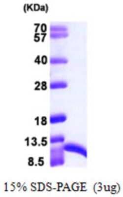 SDS-PAGE: Recombinant Human S100A6 His Protein [NBP1-51037]