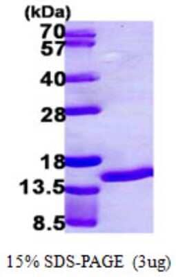 SDS-PAGE: Recombinant Human S100A7/Psoriasin His Protein [NBP1-51061]