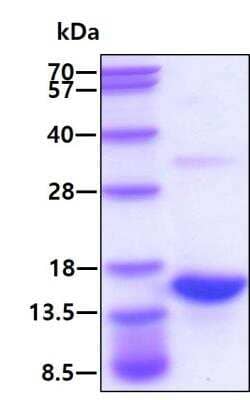 SDS-PAGE: Recombinant Human S100A9 His Protein [NBP1-44500]