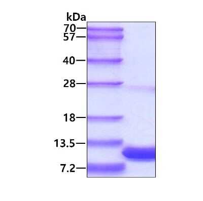 SDS-PAGE: Recombinant Human S100P His Protein [NBP1-44442]