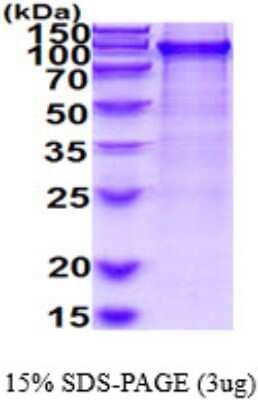 SDS-PAGE: Recombinant Human SAE2 His Protein [NBP2-50574]